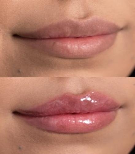 product-thumb-filter