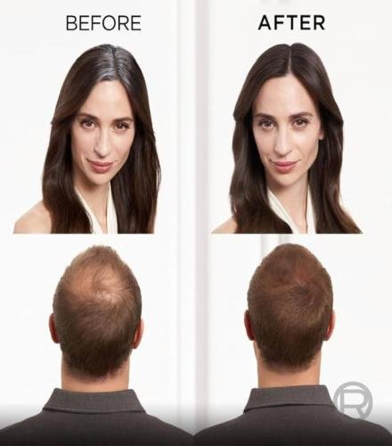 product-thumb-filter