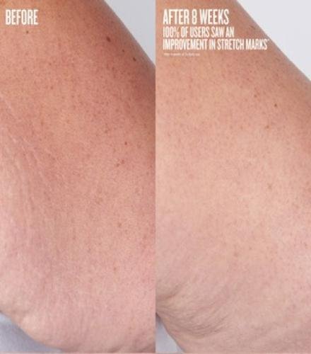 product-thumb-filter