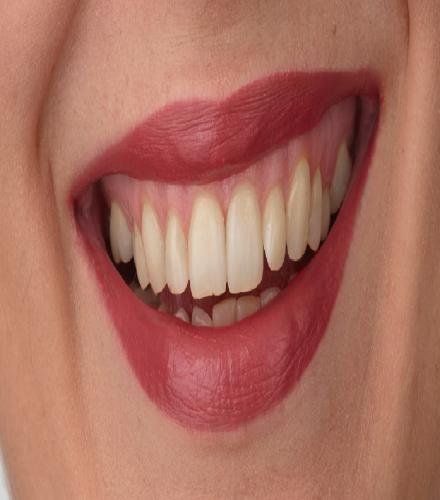 product-thumb
