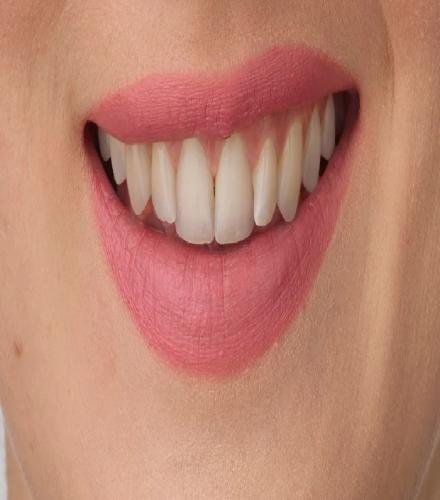 product-thumb