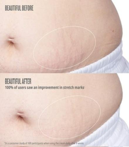 product-thumb-filter