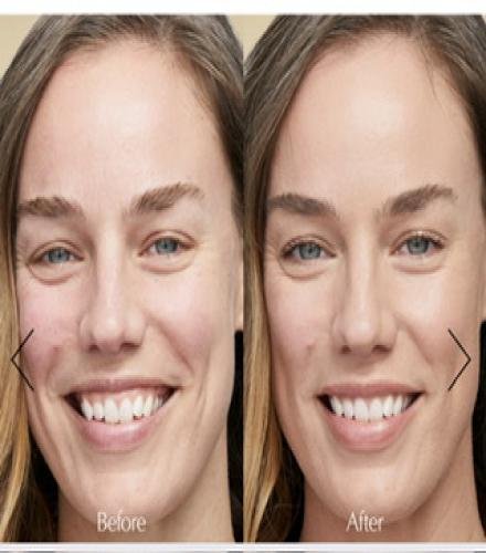 product-thumb-filter