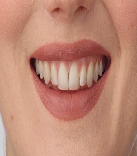 product-thumb